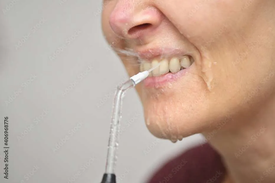 Water Flosser Benefits